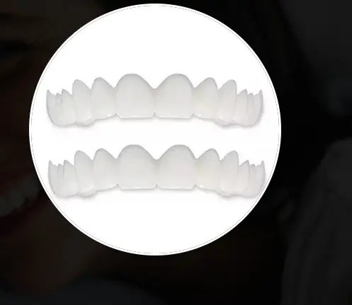 SwiftSmile Teeth Brace