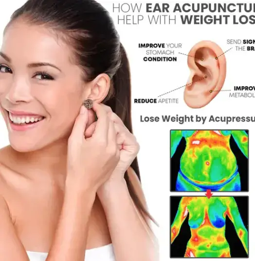 Ear Allure Weight Loss Earrings review 