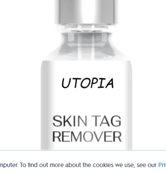 Utopia Skin Tag Remover