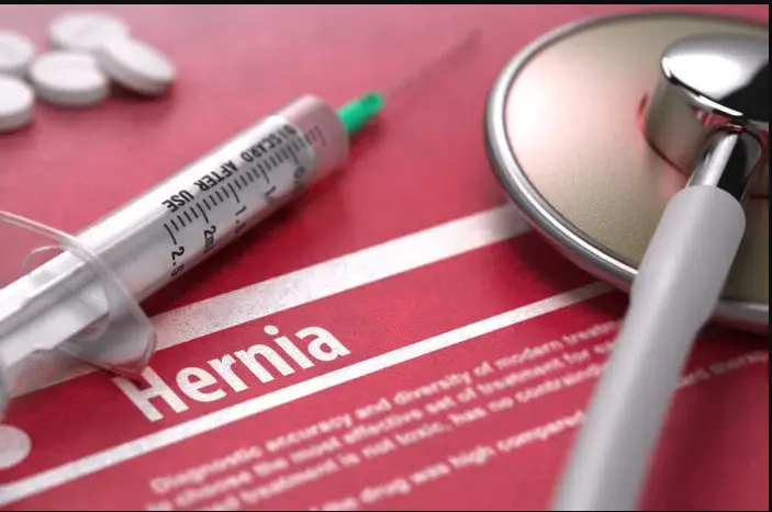 Hernia mesh